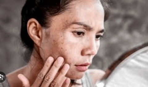 Solusi Kulit Kusam dan Kasar Meskipun Sudah Pakai Pelembab